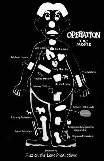 Operation